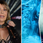 No hay daño en el pie de Jackson